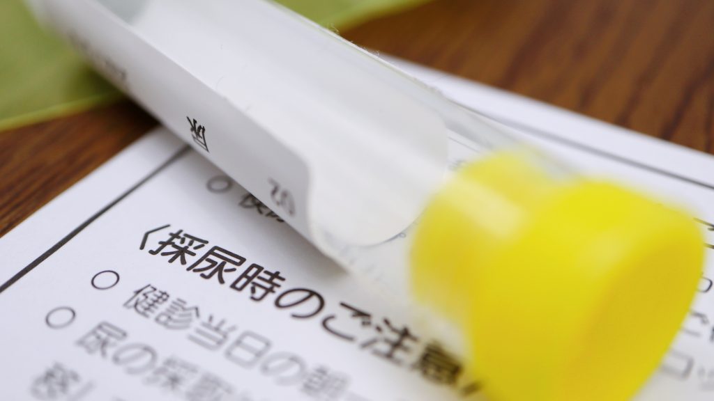 採尿のボトル